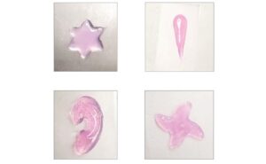 3D printing directly in the human body