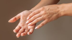 Palms that scratch? Here's what it hides, according to Dr. Kierzek