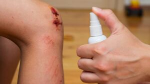 Do you think you have to leave a wound in the open air? Here's why it's a bad idea
