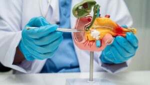 Liver cancer: these two discreet signs to spot in the toilet before it is too late