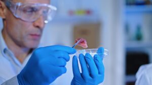 Poisoning in Escherichia coli in Aisne: Dr. Kierzek's advice to avoid this invisible danger on your plate