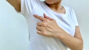 Arms that rub in summer: Dr. Kierzek's advice to avoid this unpleasant irritation