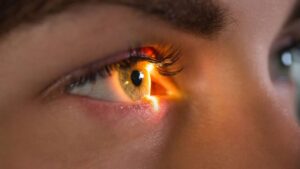 Detect schizophrenia by gaze in 60 seconds