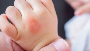 Mosquitoes: do not do that to your baby under 6 months old, warns an expert