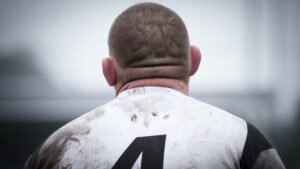 Why do rugby players have "cauliflower" ears?