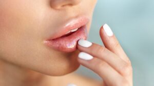 Beware of this summer beauty gesture which could seriously damage your lips