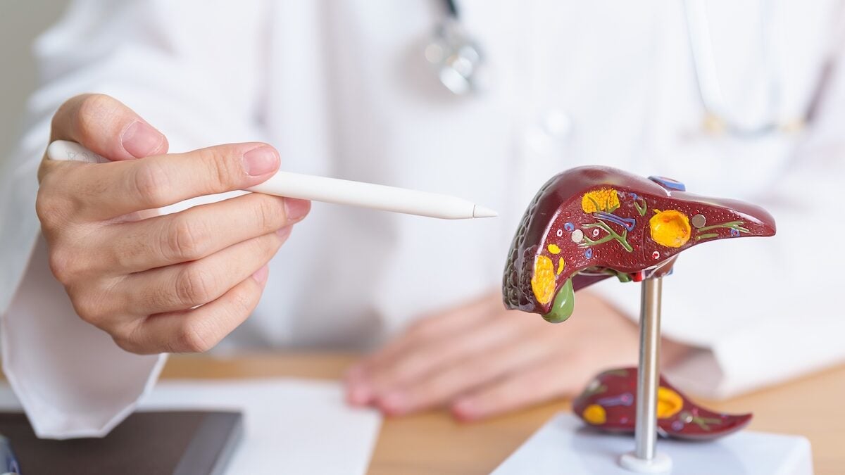 Hepatitis A: increase of 356 % of cases in Lyon, the symptoms to know and how to protect yourself
