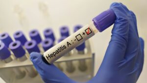 Hepatitis A: The outbreak is intensifying in Loire-Atlantique, here is how to protect it