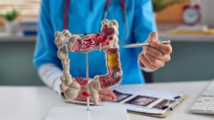 I am a specialist in colorectal cancer, here is what you must know to act in time