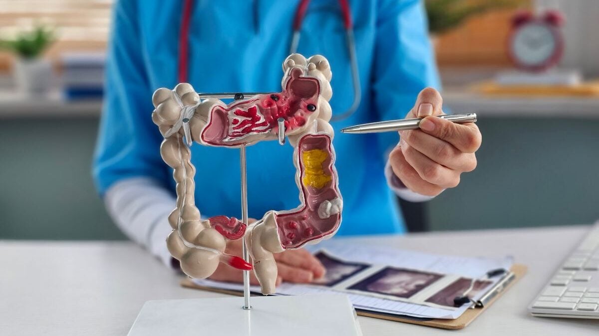 I am a specialist in colorectal cancer, here is what you must know to act in time