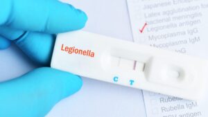 Legionellosis in Savoy, 17 cases including a death in Albertville: how to identify signs and avoid risks