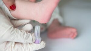 Neonatal screening: three new serious diseases detected from birth in France