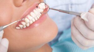 Pancreas and dental health cancer, some mouth microbes triple the risk of tumors
