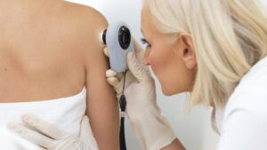 Suspicious beauty grain, how to recognize melanoma before it is too late