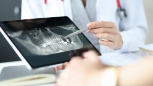 81 teeth in a jaw: Info or Intox? A dentist answers
