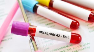 BRCA1 cancer resistant to treatments, a scientific breakthrough could change everything
