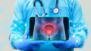 Bladder cancer: dual therapy revolutionizes the treatment of invasive forms