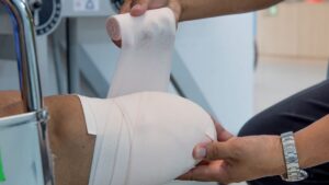 “I thought I had the flu”: Levi, 20, leg amputated after devastating sepsis