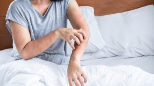 Is your skin itchy for no reason? Here's What Your Body Is Trying to Tell You According to Dr. Kierzek