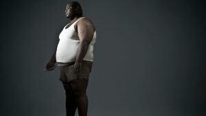 Obesity in France: it is time to put an end to these prejudices which delay treatment
