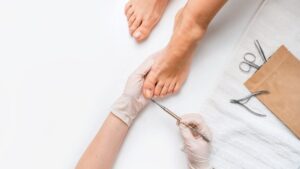 This sign on your toes is something to watch out for, it can indicate high cholesterol levels!