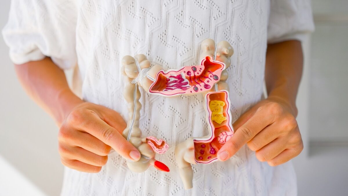 Ultra-processed foods could explain the increase in colon cancer among young people