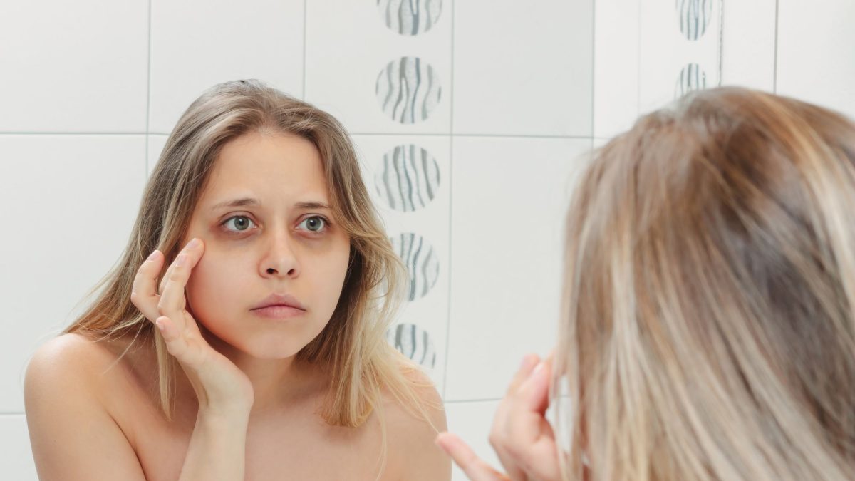 Five homemade tips to say goodbye to dark circles without breaking the bank