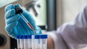 Which organ ages the most in you? A simple blood test lets you know