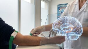 Alzheimer's: this simple blood test in midlife could identify an early risk