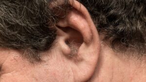 Hair in the ears, why they appear and how to remove them safely according to a dermatologist