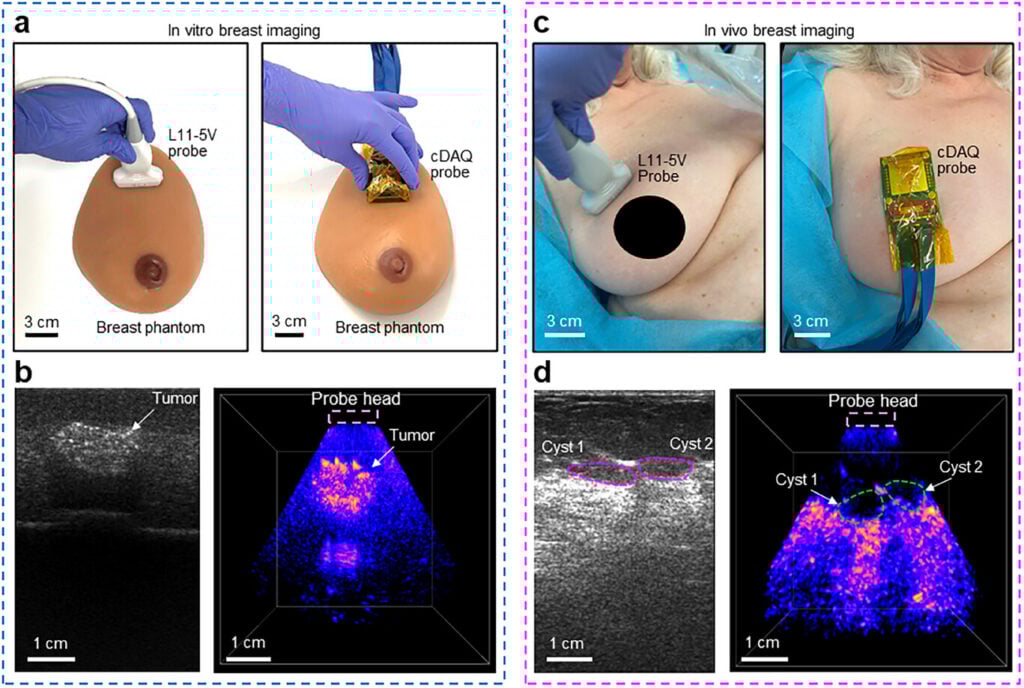 In vitro study on a breast phantom and in vivo study on breast tissue