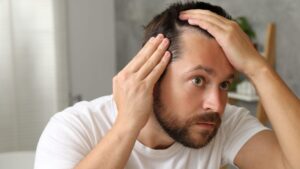 Hair loss ruins the love lives of many men