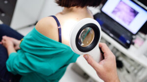 Melanoma, this cancer that we track down on the skin… can also nestle in this unexpected place