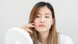 When a scar stays red for too long, what's really happening?