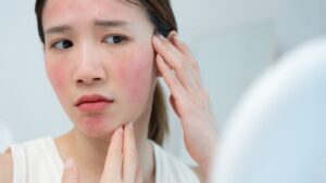These itchy facial treatments are a hit on TikTok: what the videos forget to say about your skin