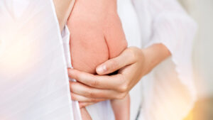 Diaper rash or mycosis? Dr Jules Fougère (Les Maternelles) reveals the sign to avoid making mistakes again