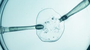 IVF with three “parents”: medical hope or ethical challenge? Science takes a new step