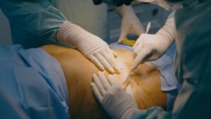 Stomach ache: he goes to the emergency room, the doctors then discover an object lodged in his body for 20 years