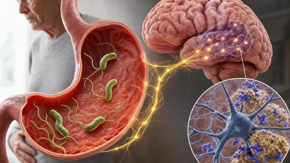 Helicobacter pylori: intestinal bacteria could play a key role in protecting the brain against Alzheimer's disease