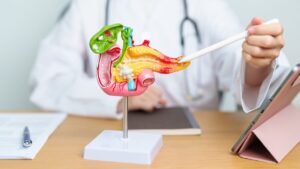 Pancreatic cancer, this screening program comes as cases could increase eightfold