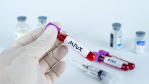 Arrested at the airport with 113 vials, two virologists allegedly tried to import the mpox virus into the United States