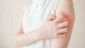 Lung cancer: 6 visible signs on the skin that you should never ignore