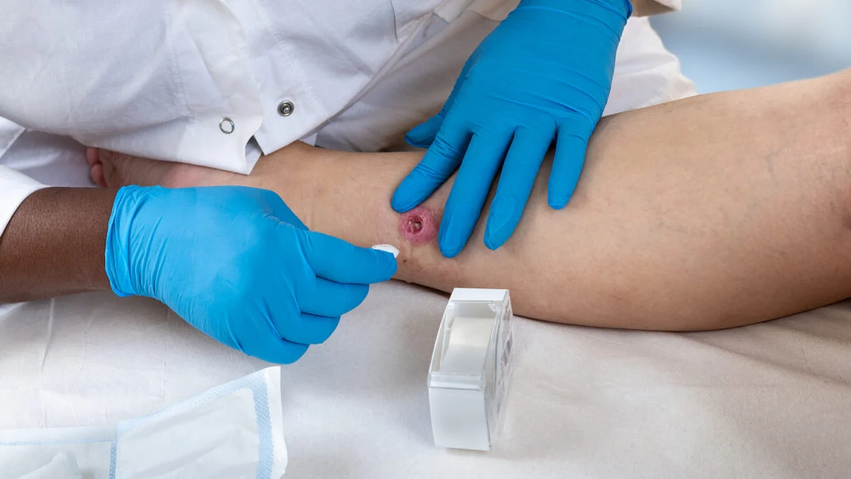 Verneuil disease: the hope of new revolutionary treatments being tested at the Nantes University Hospital