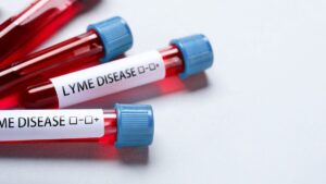 Lyme disease: the new lead that could put an end to doubt after a tick bite