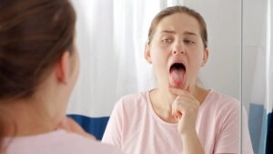 True or false health: a white tongue is always a sign of poor hygiene?