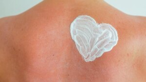 After-sun: the 10 treatments rated 100/100 on Yuka to slip into your vacation kit