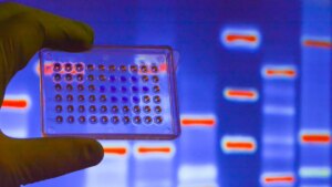 Lung cancer: a simple blood test for 55 euros could tomorrow avoid biopsies