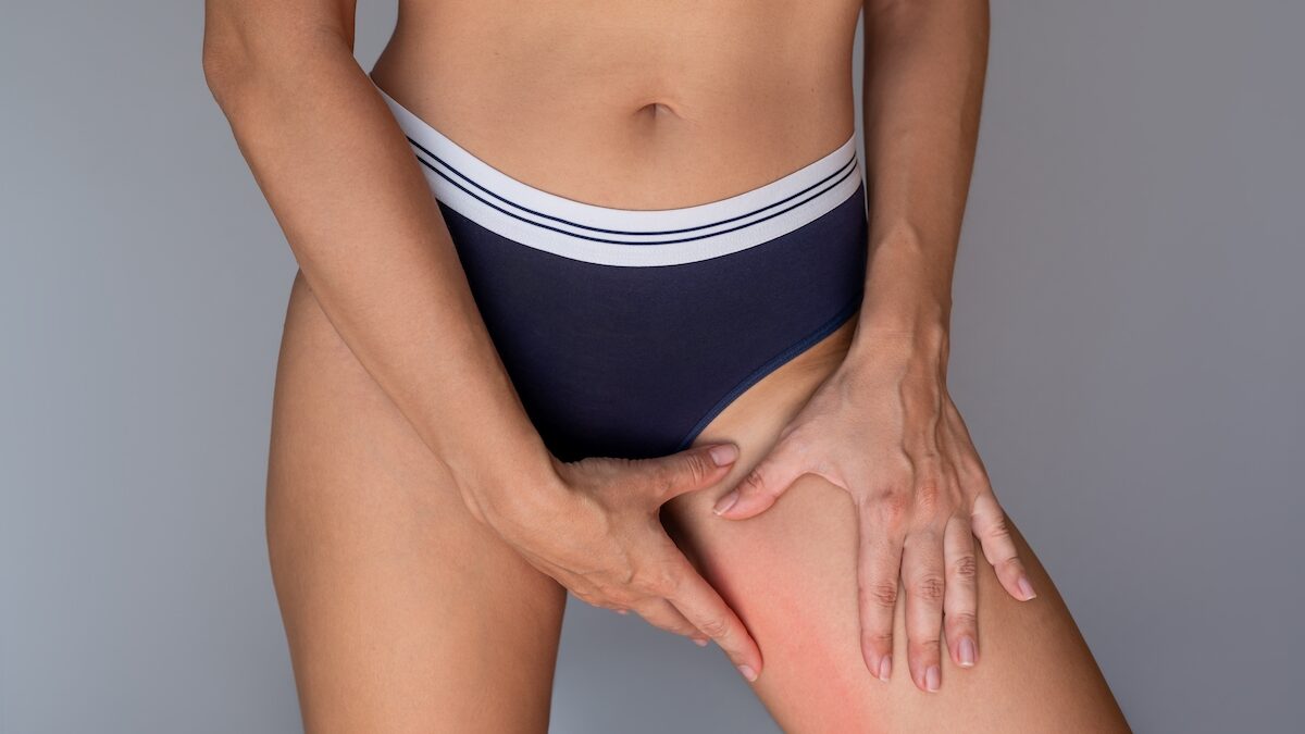 Thighs that rub: the “usual” tips (talcum powder, deodorant, etc.) are false good ideas according to a dermatologist