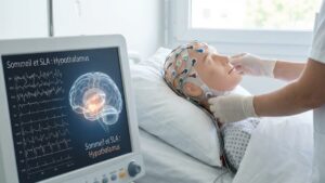 Charcot disease: watch out for these sleep disorders which could be an early sign