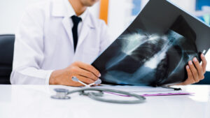 Chest scanner: the 3 windows you need to know to better understand the images